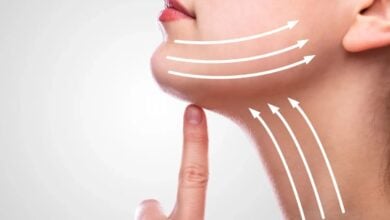 Photo of Neck Liposuction and the Jawline: Five Assumptions, Checked